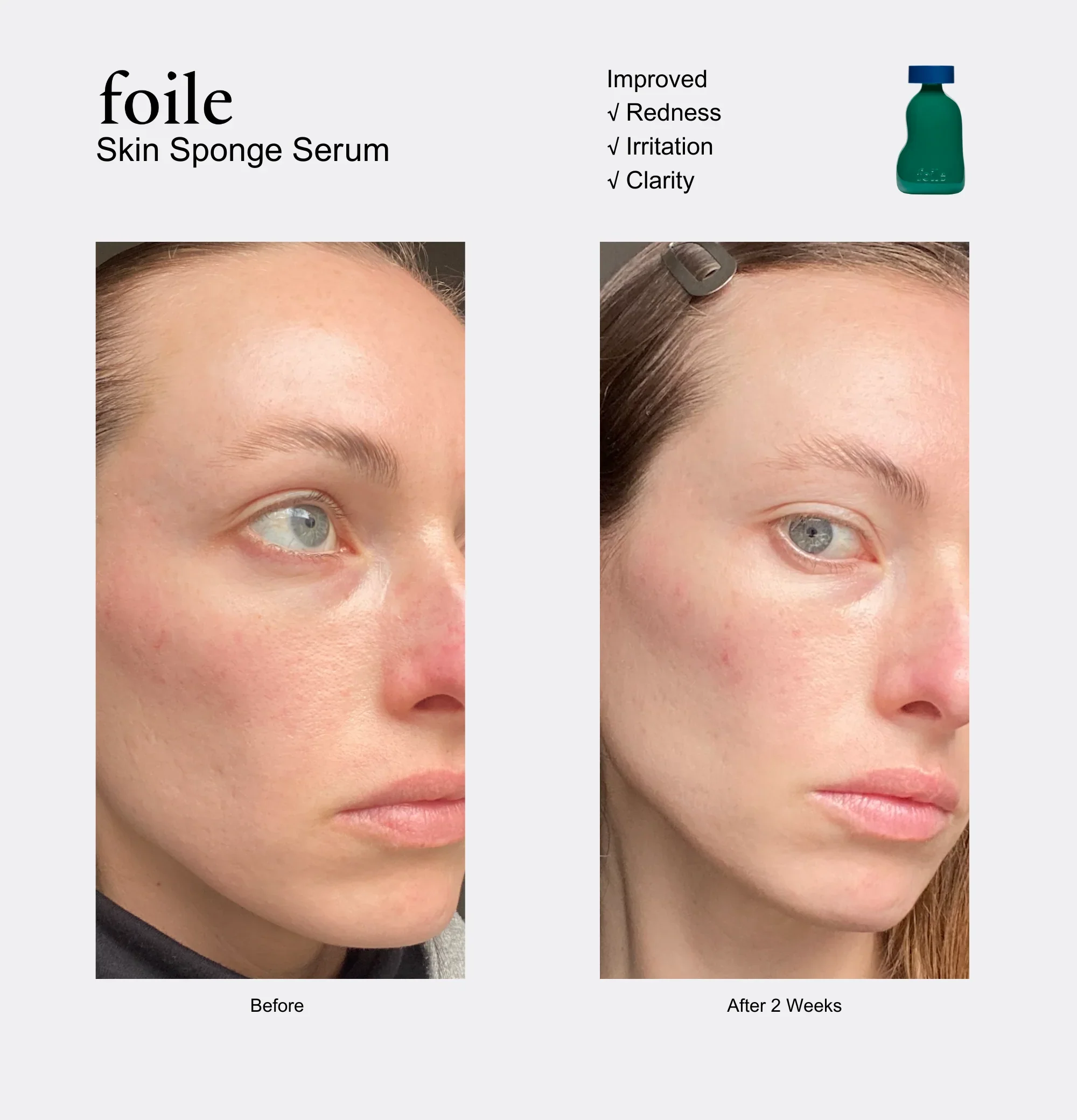 Skin Sponge Serum 50ML - Image 6